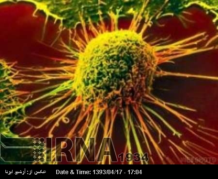 Iranian researcher discovers new cancer biomarker Iranian researcher discovers new cancer biomarker