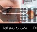 Iranian researchers use stem cells in retina disorders Iranian researchers use stem cells in retina disorders