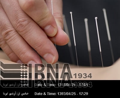 Role of material and energy in acupuncture Role of material and energy in acupuncture