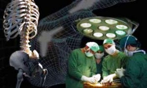 جراحیهای بسته ستون فقرات با 90 درصد موفقیت در ایران انجام میشود جراحیهای بسته ستون فقرات با 90 درصد موفقیت در ایران انجام میشود