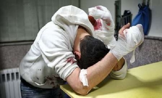 حوادث ناشي از مواد محترقه در زنجان 92 نفر را راهي مراكز درماني كرد حوادث ناشي از مواد محترقه در زنجان 92 نفر را راهي مراكز درماني كرد