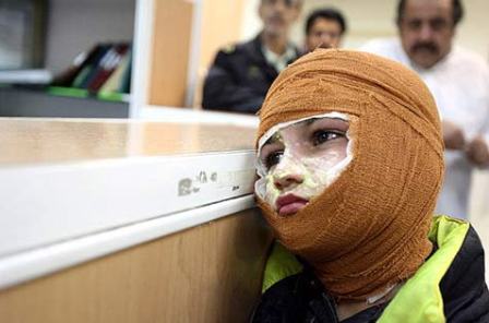 حوادث چهارشنبه سوری 421 مصدوم و سه كشته برجای گذاشته است حوادث چهارشنبه سوری 421 مصدوم و سه كشته برجای گذاشته است