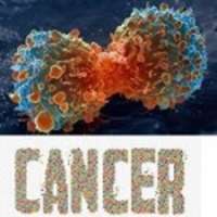 ازبين رفتن مقاومت دارويي تومور با نانوداروي ضدسرطان