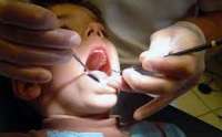 27 هزار دانش آموز كاشانی تحت پوشش طرح  سلامت دهان و دندان قرار می گیرند