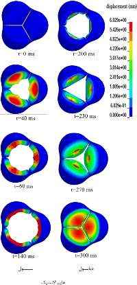 شبيه سازي عددي دريچه آئورت قلب توسط دانشجوي دانشگاه اميركبير