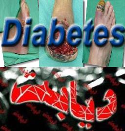 درمان عفونت زخم مزمن پای دیابتی با روش فتودینامیك تراپی در ایران