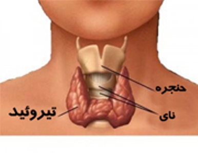 استعمال سیگار بروز بیماری پركاری تیروئید را تشدید می كند