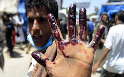 ابعاد حقوق بشری حمله عربستان به یمن