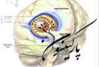 استفاده از نانوذرات براي تحريك نواحي عميق مغز