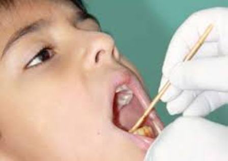 7 میلیون دانش آموز ابتدایی زیرپوشش طرح سلامت دهان و دندان قرار می گیرند