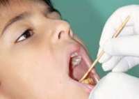7 میلیون دانش آموز ابتدایی زیرپوشش طرح سلامت دهان و دندان قرار می گیرند