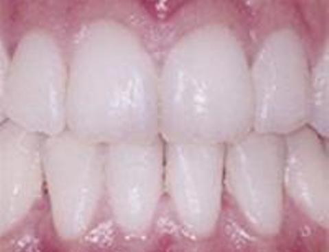 كم خطرترين درمان مشكلات زيبايي دندانها آموزش داده مي شود