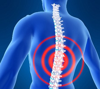 تسكین درد ستون فقرات با ایمپلنت نخاعی