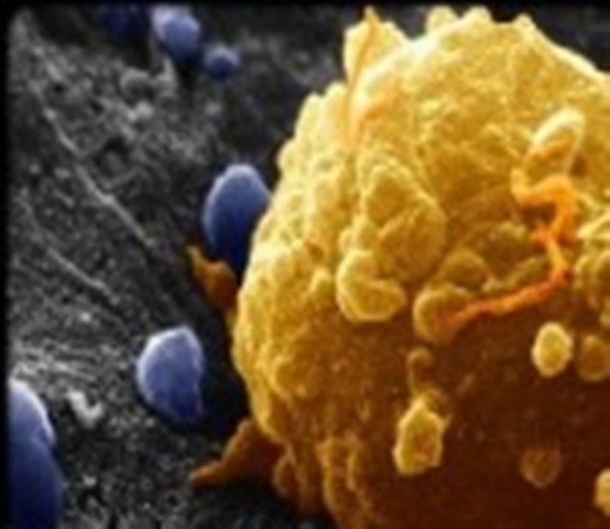 تشخيص سلول هاي سرطاني با استفاده از نانوبلورها