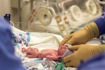 30 درصد نوزادان نارس در كشور به بيماري شبكيه دچار مي‌شوند
