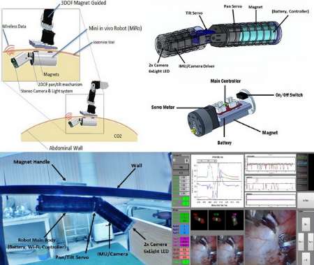 ربات آندوسكوپی محققان دانشگاه امیركبیر به كمك جراحان می آید