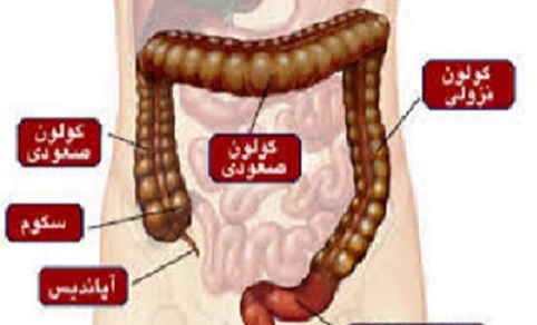 علائم سرطان روده بزرگ را جدي بگيريد علائم سرطان روده بزرگ را جدي بگيريد