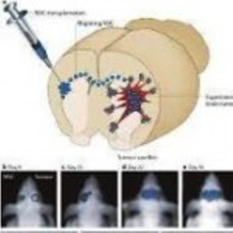 موفقیت استفاده از نانوذرات برچسب‌دار بر درمان جراحات مغز