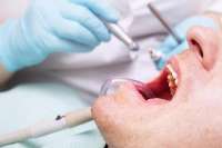 بیماران كلیوی بهداشت دهان و دندان را جدی بگیرند