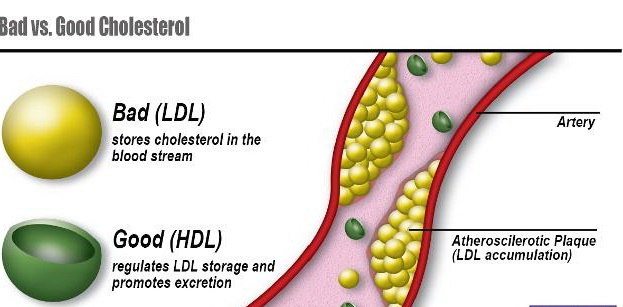 كلسترول خوب هميشه هم خوب نيست