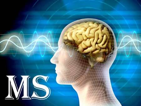 حمايت هر چه بيشتر از بيماران ام اس نيازمند مشاركت خيران است
