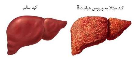 یك متخصص: قمه زنی از عوامل اصلی ابتلا به هپاتیت است