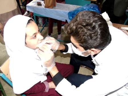اجرای طرح وارنیش فلوراید برای دندان های 53 هزار دانش آموز استان ایلام