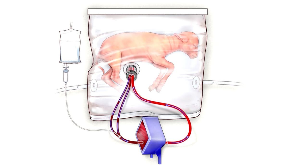 ساخت رحم مصنوعی برای نجات نوزادان نارس