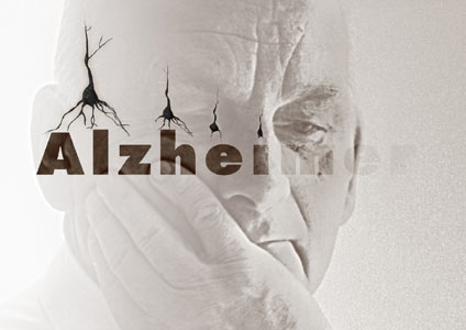 پنج عامل مهم در پيشگيري از دمانس و آلزايمر