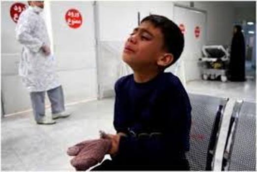 سوختگی 200 هزار نفری در سال با 3 هزار مرگ سوختگی 200 هزار نفری در سال با 3 هزار مرگ
