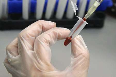 ذخیره سازی 85 هزار نمونه خون بند ناف در كشور