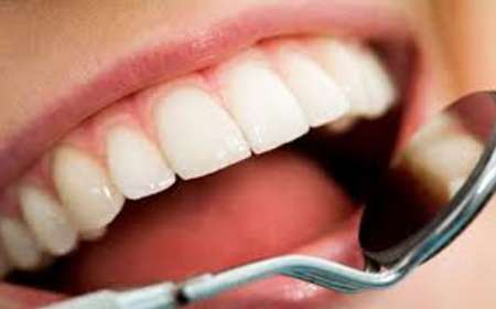 شاخص پوسیدگی دندان در كشور افزایش یافته است