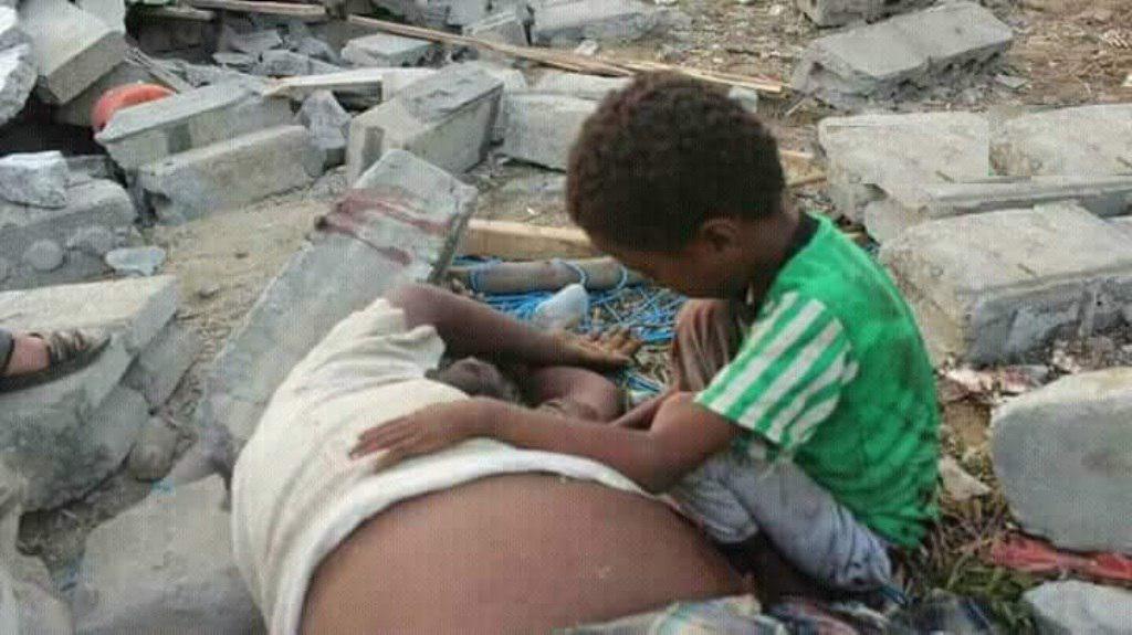 Saudi bloody wedding game in Yemen Saudi bloody wedding game in Yemen