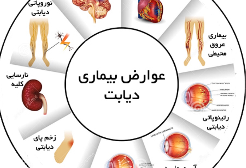 ديابت ؛ شاهراه ورود به مسير مرگ خاموش