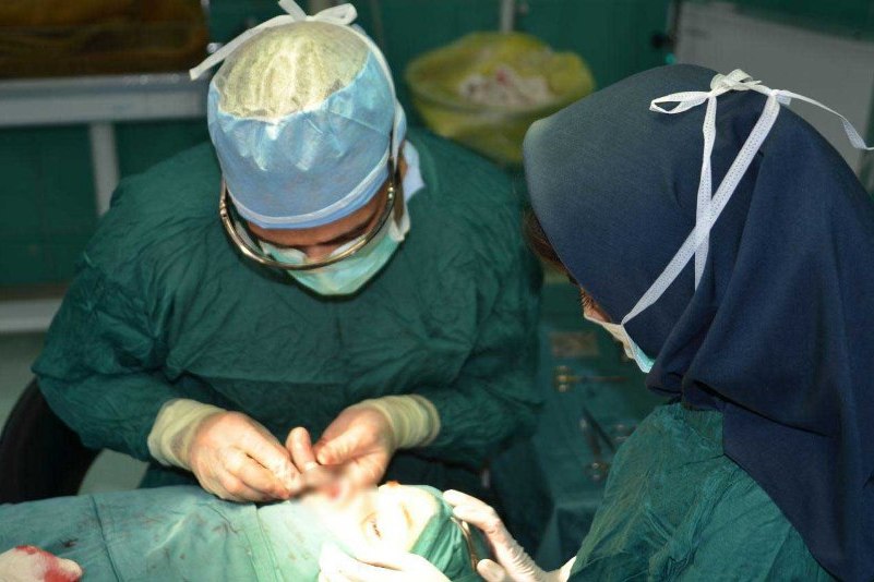 افراد غیر متخصص جراحی گوش الاغی و چشم گربه ای انجام می دهند