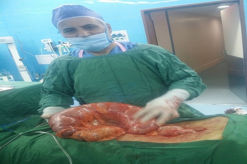 جراحي رفع انسداد روده براي نخستين بار در آستارا انجام شد جراحي رفع انسداد روده براي نخستين بار در آستارا انجام شد
