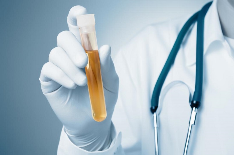 Shiraz researchers design sensors for diagnosis of urinary infections Shiraz researchers design sensors for diagnosis of urinary infections