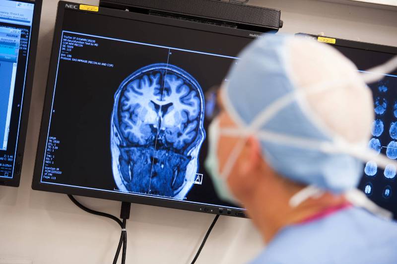1.3m Iranians suffering epilepsy 1.3m Iranians suffering epilepsy
