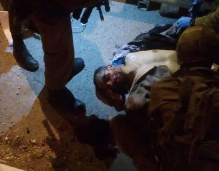 Israeli forces' attack injures 100 Palestinian detainees Israeli forces' attack injures 100 Palestinian detainees