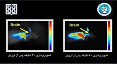 مسیر دارو رسانی به مغز ردیابی شد