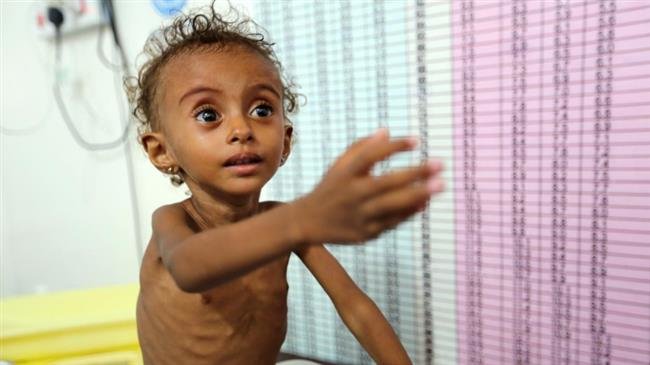 UN urges more aid to Yemeni people UN urges more aid to Yemeni people