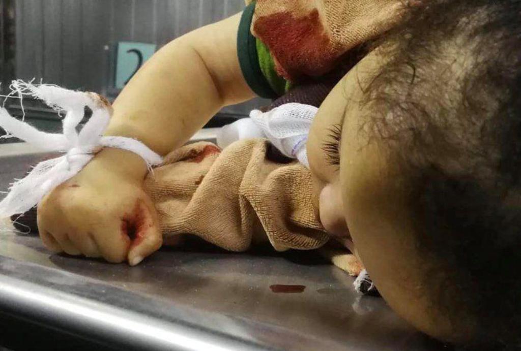 17 Palestinians killed in Gaza 17 Palestinians killed in Gaza