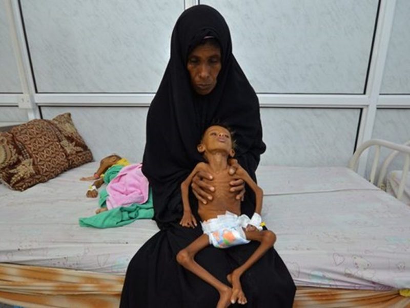 سازمان ملل نسبت به خطر گرسنگي 10 ميليون يمني هشدار داد سازمان ملل نسبت به خطر گرسنگي 10 ميليون يمني هشدار داد
