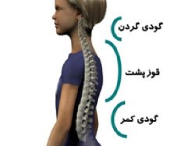 80درصد دانش آموزان خراسان رضوی به ناهنجاری ساختارقامتی مبتلایند 80درصد دانش آموزان خراسان رضوی به ناهنجاری ساختارقامتی مبتلایند