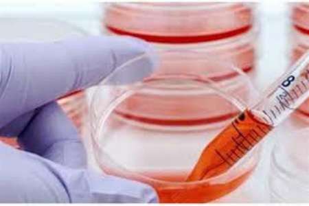 Iran conducts 1st HIV blood stem cells transplant in Mideast Iran conducts 1st HIV blood stem cells transplant in Mideast